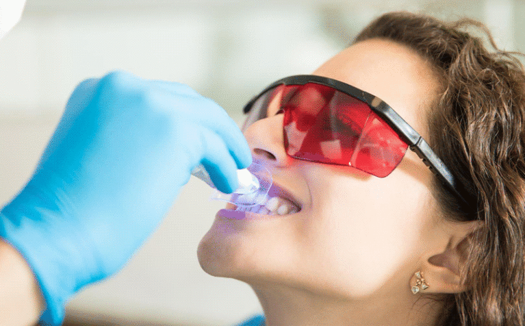 Hollywood-Smile-&-Zoom-Whitening-in-Qatar