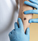 Wart Removal in Qatar – Safe, Fast & Effective Treatment at American Hospital Doha