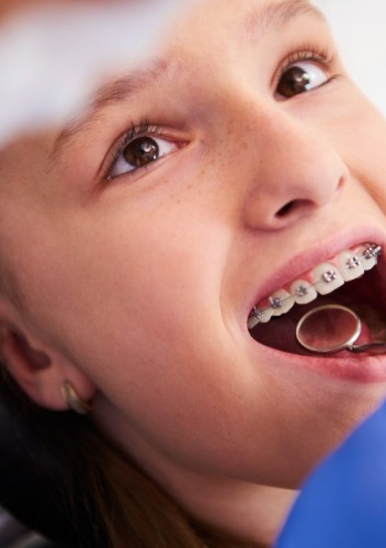 Is Orthodontic Treatment Only for Children
