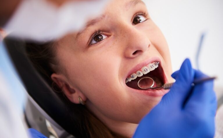Is Orthodontic Treatment Only for Children