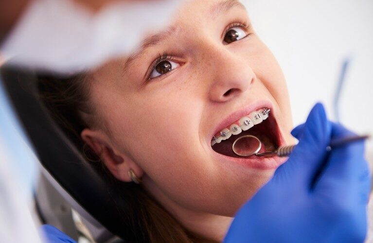 Is Orthodontic Treatment Only for Children