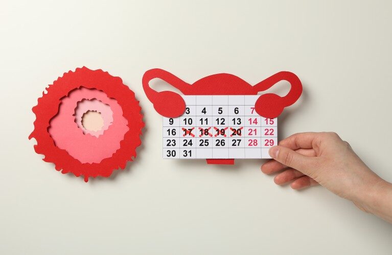 Are Irregular Periods a Cause for Concern? When to See a Doctor in Qatar