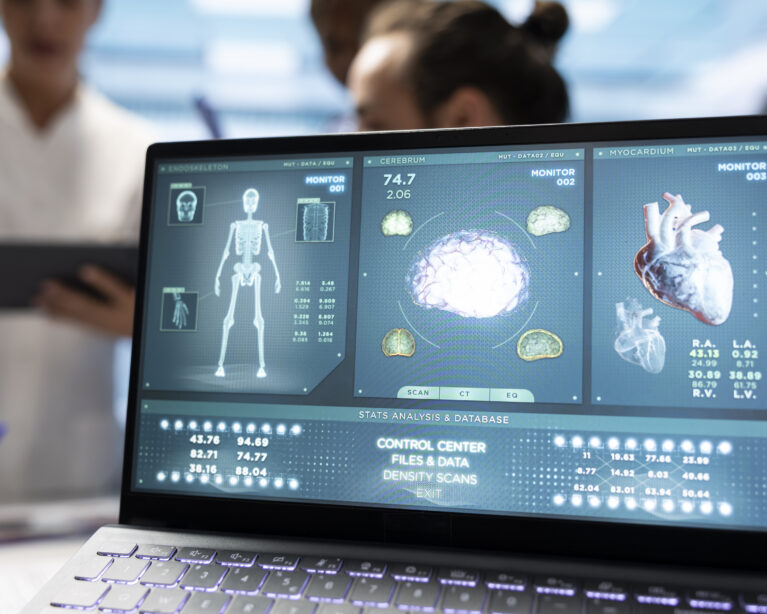 AI cardiology patient care Qatar