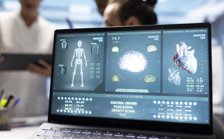 AI cardiology patient care Qatar
