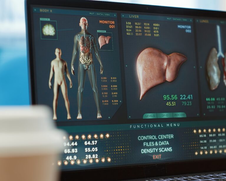 robotic kidney stone surgery Qatar