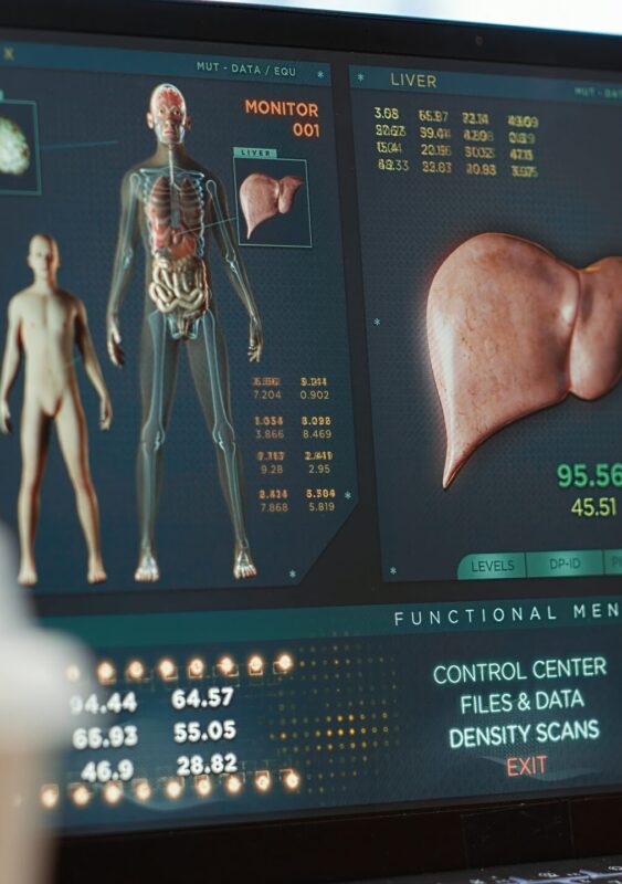 robotic kidney stone surgery Qatar