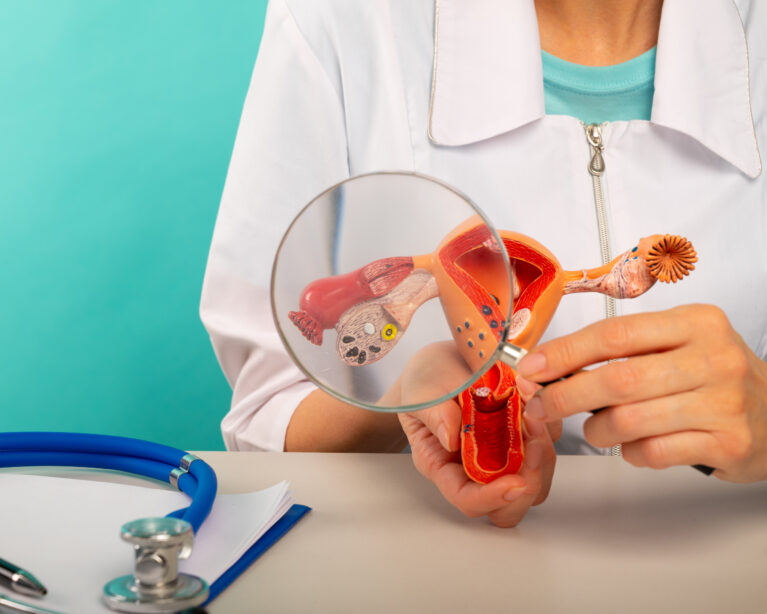 ovarian cancer symptoms Qatar