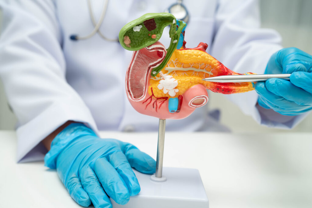 gallstones vs appendicitis Qatar