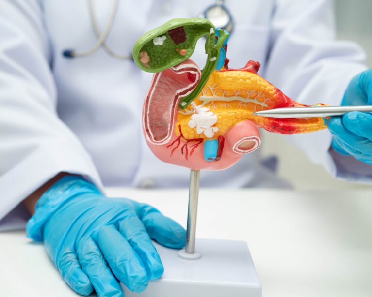 gallstones vs appendicitis Qatar