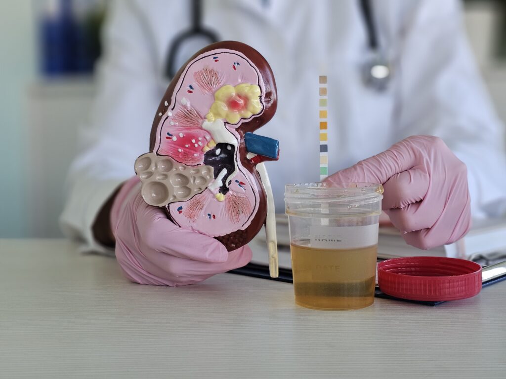 blood in urine causes treatment Qatar