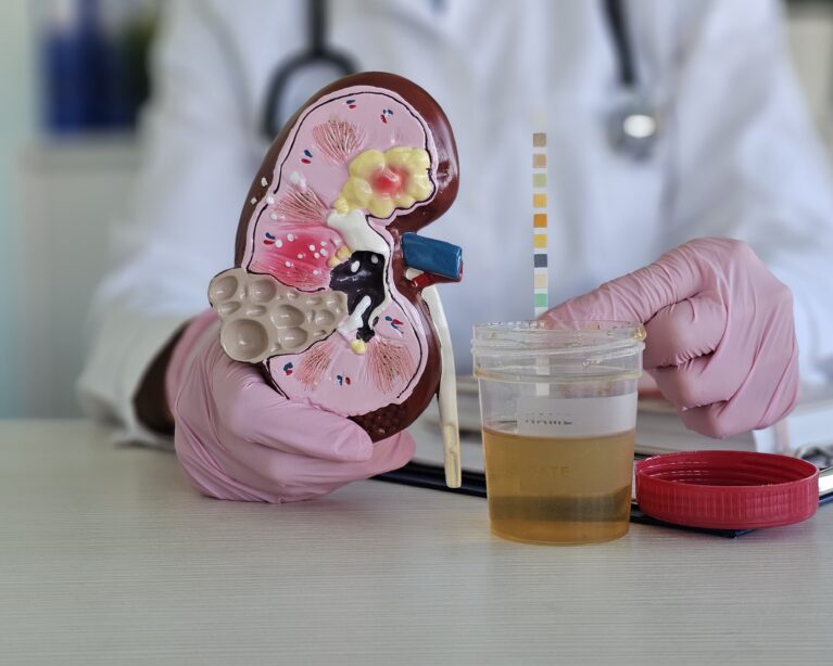 blood in urine causes treatment Qatar