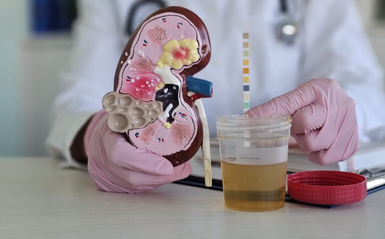 blood in urine causes treatment Qatar