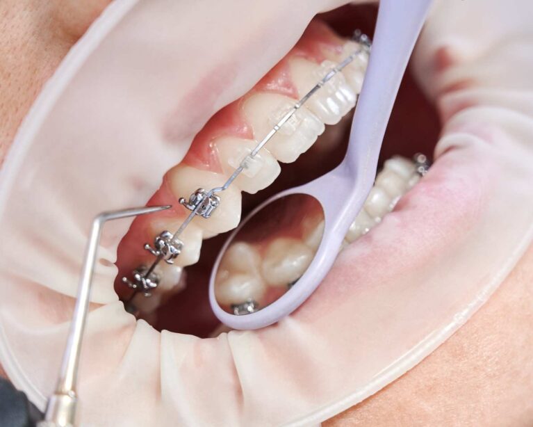 Orthodontic