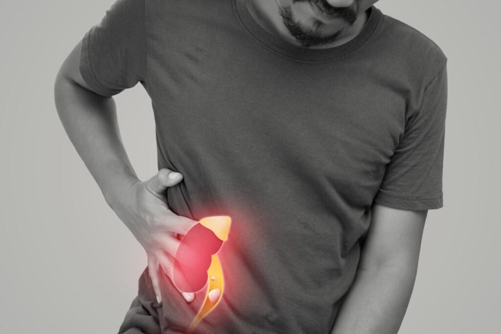 Kidneys highlighting the formation of kidney stones.