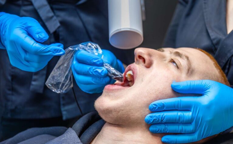 Professional dental care for nicotine-stained teeth.