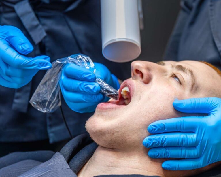 Professional dental care for nicotine-stained teeth.