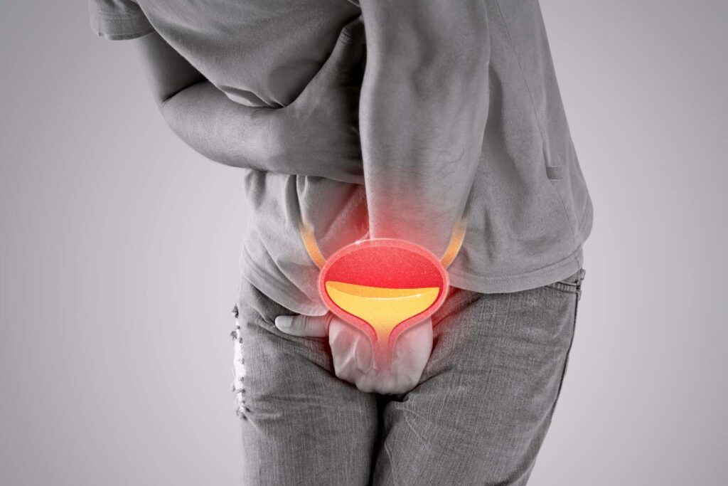 Illustration of urinary tract infection symptoms affecting the bladder and urinary system.