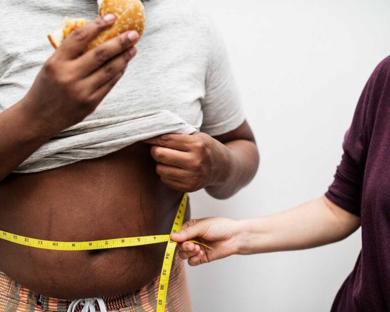Obesity evaluation and treatment